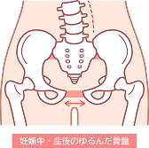 産後の骨盤図解